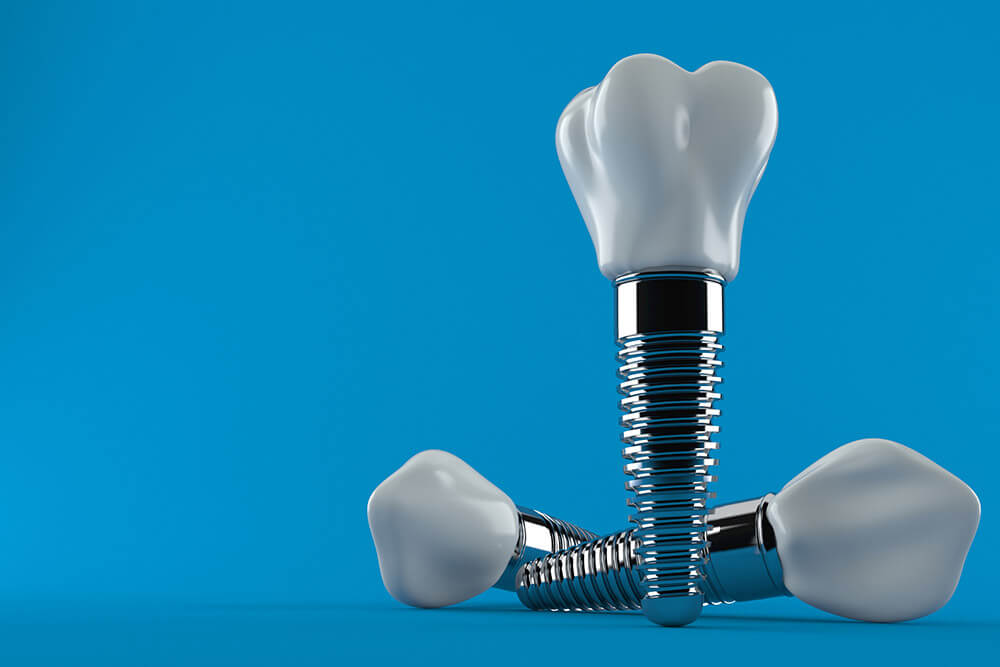Are Dental Implants Safe? Finger Lakes Dental 5 NY Locations