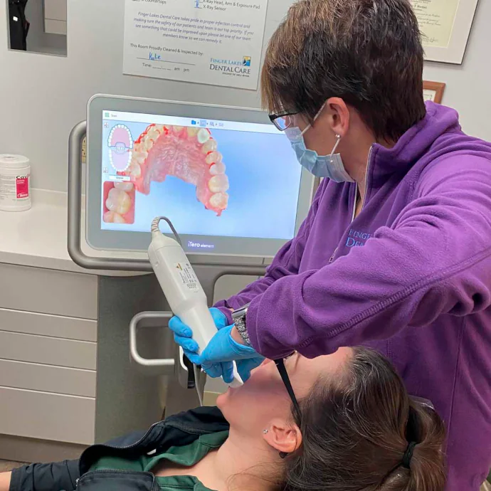 iTero Digital Dental Scanner in Finger Lakes, NY at Finger Lakes Dental Care